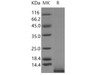 Mouse IGF1/IGF-I/IGF-1 Recombinant Protein (RPES4679)