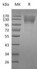 Mouse CD96 Recombinant Protein (His Tag) (Active) (RPES4691)