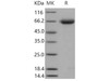 Mouse Nogo Receptor/NgR Recombinant Protein (His Tag) (Active) (RPES4692)