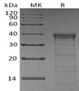 Human Cathepsin L2/CTSL2 Recombinant Protein (RPES4695)