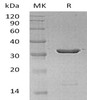 Human Galectin-8/LGALS8 Recombinant Protein (Active) (RPES4696)