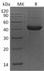 Mouse ALK4/ACVR1B Recombinant Protein (RPES4720)