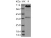 Human CALR/Calreticulin Recombinant Protein (Fc Tag) (RPES4729)
