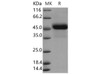 Human Reticulocalbin 3/RCN3 Recombinant Protein (aa 1-324, His Tag) (RPES4751)