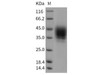 Rat CD48 Recombinant Protein (Fc Tag) (RPES4755)