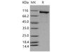 Mouse PARP Recombinant Protein (His Tag) (Active) (RPES4756)