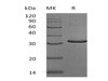 Human MOB4/MOBKL3 Recombinant Protein (RPES4762)