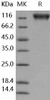 Human MERTK/MER Recombinant Protein (RPES4781)