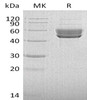Human SerpinI2 Recombinant Protein (RPES4785)