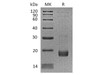 Human Troponin C/TNNC1 Recombinant Protein (RPES4792)