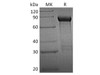 Human GFRA1/GDNFRA Recombinant Protein (RPES4804)