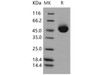 ACPP Recombinant Protein (RPES4836)