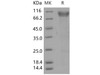 Human BLNK/Ly-57 Recombinant Protein (His Tag) (Active) (RPES4841)