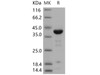 Human ACP1/LMW-PTP Recombinant Protein (GST Tag) (Active) (RPES4857)