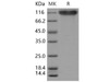 Mouse P-selectin Recombinant Protein (RPES4860)