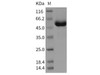 Rat CLEC4D/CLECSF8 Recombinant Protein (Fc Tag) (RPES4888)