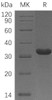 Human C1QBP Recombinant Protein (aa 75-282, His Tag) (RPES4897)