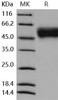 Mouse IL2RG/CD132 Recombinant Protein (His Tag) (RPES4901)