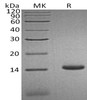 Human CCL3L1 Recombinant Protein (RPES4903)