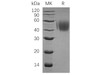 Human CD150/SLAMF1 Recombinant Protein (RPES4913)