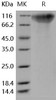 Human OMGP/OMG Recombinant Protein (aa 1-420, His Tag) (Active) (RPES4918)