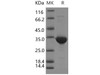 Human BVES/POPDC1 Recombinant Protein (GST Tag) (RPES4922)