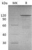 Mouse Cadherin-3/CDH3 Recombinant Protein (RPES4929)