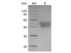 Human CD24 Recombinant Protein (RPES4934)