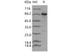 Human RACK1/GNB2L1 Recombinant Protein (His & MBP Tag) (RPES4942)