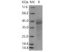 Human GPR37 Recombinant Protein (His Tag) (RPES4956)