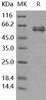 Human Noggin/NOG Recombinant Protein (aa 1-232, Fc Tag) (Active) (RPES4959)