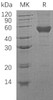 Human CD14 Recombinant Protein (RPES4965)