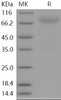 Human NRXN3 Recombinant Protein (Fc Tag) (Active) (RPES4978)