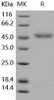 Human IL11RA/IL11Ralpha Recombinant Protein (His Tag) (Active) (RPES4985)