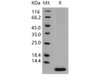 Human S100A6 Recombinant Protein (Baculovirus, His Tag) (RPES5000)