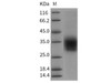Rat CLEC4A2/DCIR Recombinant Protein (His Tag) (RPES5002)