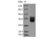 Rat CLEC4B2/mDCAR1 Recombinant Protein (His Tag) (RPES5021)