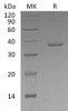 Human STAT5B Recombinant Protein (RPES5029)