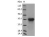 Rat LTBR/TNFRSF3 Recombinant Protein (His Tag) (RPES5030)