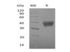 Mouse SIGLEC3/CD33 Recombinant Protein (RPES5034)
