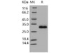 Human TIMP/TIMP1 Recombinant Protein (His Tag) (Active) (RPES5039)
