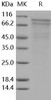 Human R-Cadherin/CDH4 Recombinant Protein (His Tag) (Active) (RPES5044)
