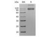 Human CD200R1 Recombinant Protein (RPES5045)