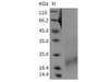 Rat BAFFR/TNFRSF13C Recombinant Protein (His Tag) (RPES5049)