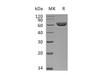 Mouse SES1D Recombinant Protein (RPES5050)