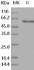 Human Layilin/LAYN Recombinant Protein (Fc Tag) (RPES5084)