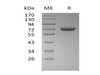 Human GALNT7 Recombinant Protein (RPES5087)