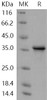Human TWF1/Twinfilin Recombinant Protein (RPES5096)