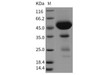 Rat CLEC2D/OCIL Recombinant Protein (Fc Tag) (RPES5099)