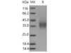 Mouse CD16-2/FCGR4 Recombinant Protein (RPES5101)
